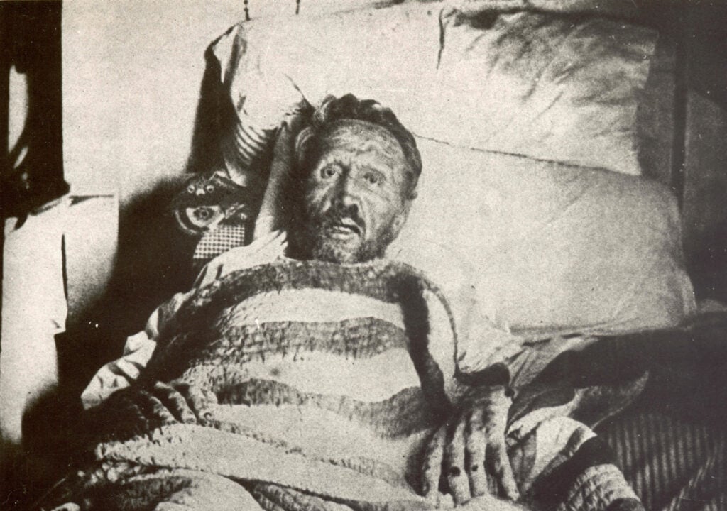 Pater Damiaan op zijn sterfbed