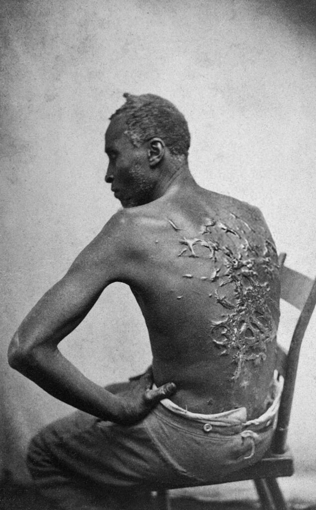 The Scourged Back, beroemde anti-slavernijfoto uit 1863